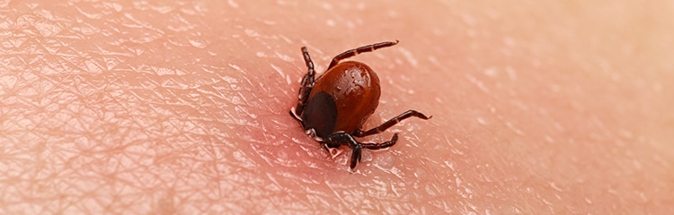 Tick Biting Human